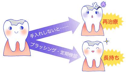 歯の再治療